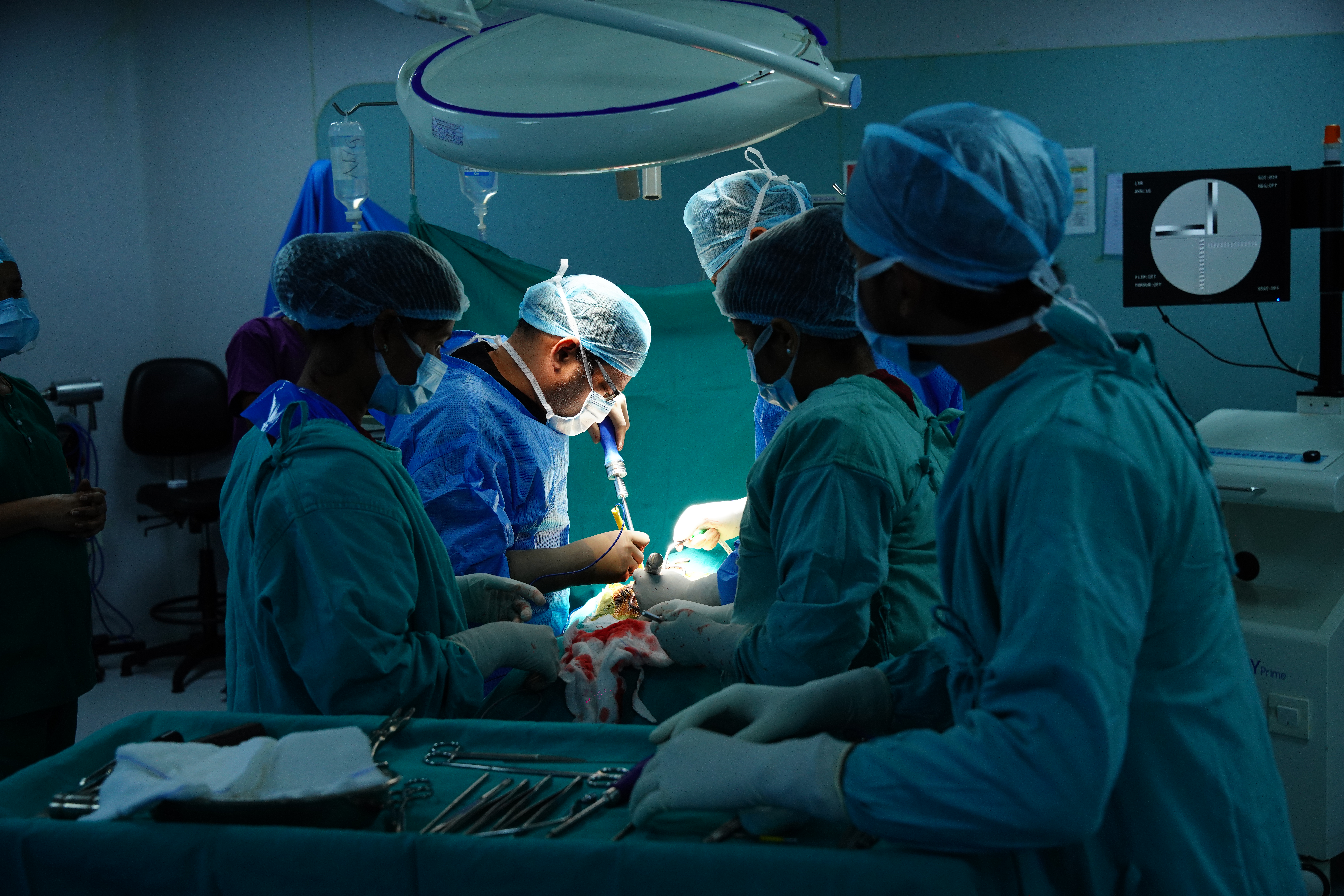 Revision spine surgery