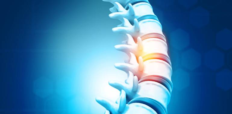 Osteoporotic Spine Fractures Treatment